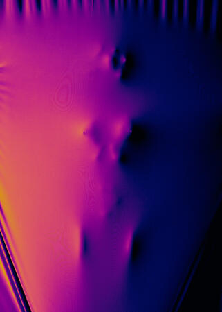 Body